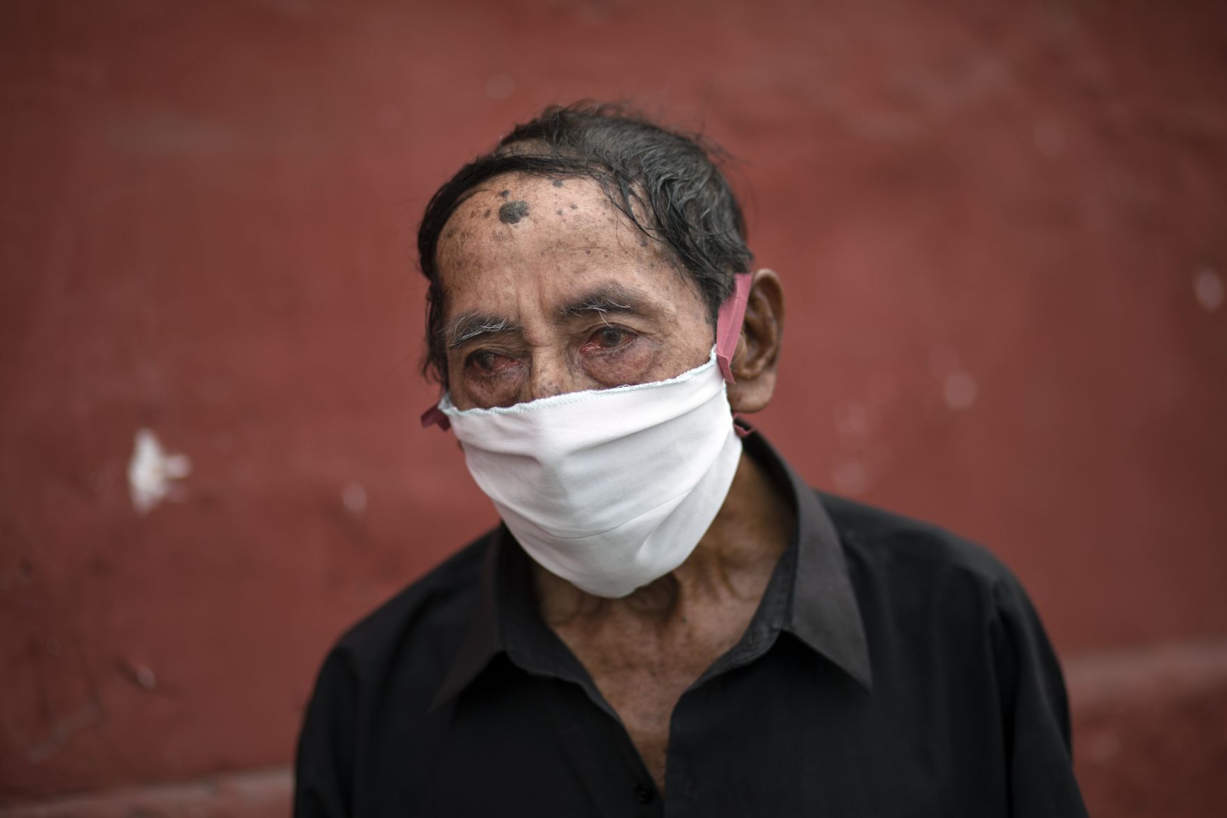 APTOPIX Virus Outbreak Peru
